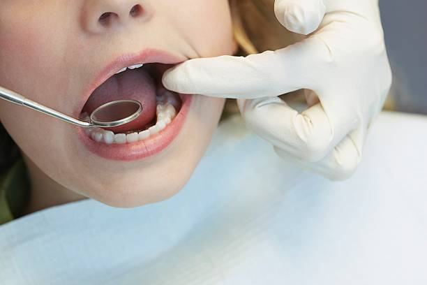 many children have dental sealants
